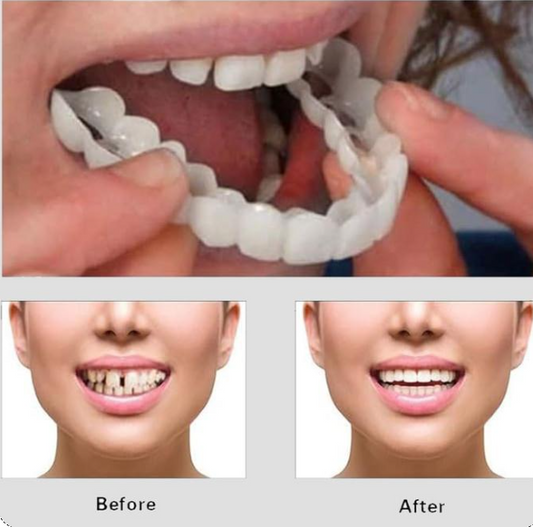 😁 EclatSmil – Un Nouveau Sourire en 30s